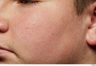  HD Face skin references Abraham Hurtado cheek nose skin pores skin texture 0004.jpg